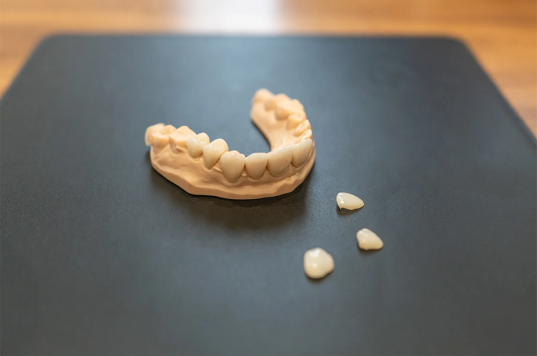 Facettes dentaires sur fond noir