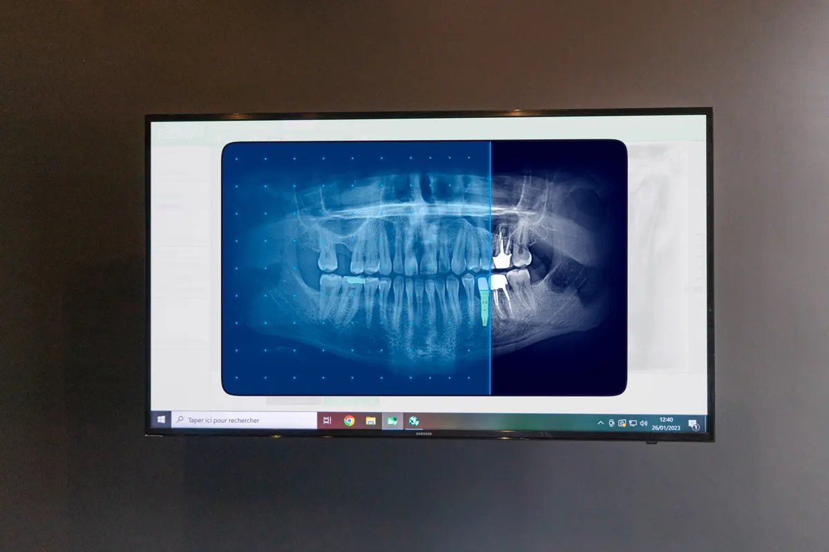 Allison Opal Dental Studio